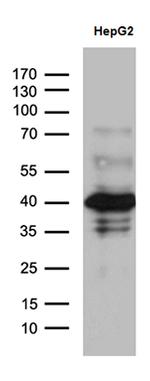ZNF670 Antibody in Western Blot (WB)