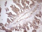 ZNF69 Antibody in Immunohistochemistry (Paraffin) (IHC (P))