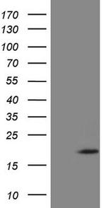ZNF69 Antibody in Western Blot (WB)