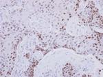 ZNF690 Antibody in Immunohistochemistry (IHC)