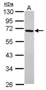 ZNF690 Antibody in Western Blot (WB)