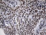 ZNF705D Antibody in Immunohistochemistry (Paraffin) (IHC (P))