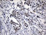 ZNF705D Antibody in Immunohistochemistry (Paraffin) (IHC (P))