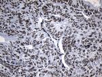 ZNF705D Antibody in Immunohistochemistry (Paraffin) (IHC (P))
