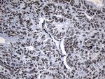 ZNF705D Antibody in Immunohistochemistry (Paraffin) (IHC (P))