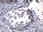ZNF705D Antibody in Immunohistochemistry (Paraffin) (IHC (P))