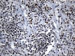 ZNF705D Antibody in Immunohistochemistry (Paraffin) (IHC (P))