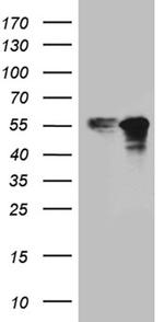 ZNF718 Antibody in Western Blot (WB)