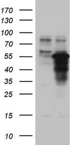 ZNF718 Antibody in Western Blot (WB)