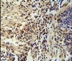 ZNF720 Antibody in Immunohistochemistry (IHC)