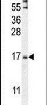 ZNF720 Antibody in Western Blot (WB)