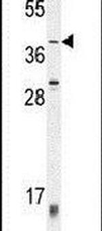 ZNF763 Antibody in Western Blot (WB)