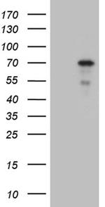 ZNF8 Antibody in Western Blot (WB)
