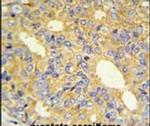 ZNF9 Antibody in Immunohistochemistry (IHC)
