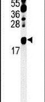ZNF9 Antibody in Western Blot (WB)