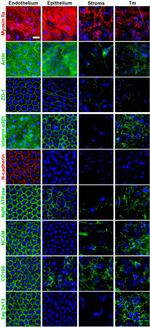 ZO-1 Antibody in Immunohistochemistry (IHC)