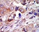 ZPK Antibody in Immunohistochemistry (IHC)