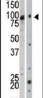 ZPK Antibody in Western Blot (WB)