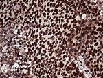 ZRANB2 Antibody in Immunohistochemistry (Paraffin) (IHC (P))