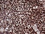 ZRANB2 Antibody in Immunohistochemistry (Paraffin) (IHC (P))
