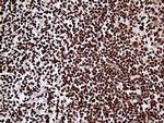 ZRANB2 Antibody in Immunohistochemistry (Paraffin) (IHC (P))