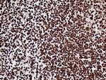 ZRANB2 Antibody in Immunohistochemistry (Paraffin) (IHC (P))