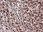 ZRANB2 Antibody in Immunohistochemistry (Paraffin) (IHC (P))