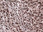 ZRANB2 Antibody in Immunohistochemistry (Paraffin) (IHC (P))