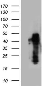 ZRANB2 Antibody in Western Blot (WB)