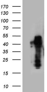 ZRANB2 Antibody in Western Blot (WB)