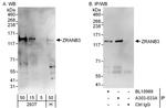 ZRANB3 Antibody in Western Blot (WB)