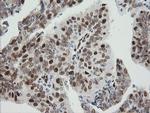 ZSCAN18 Antibody in Immunohistochemistry (Paraffin) (IHC (P))