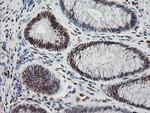 ZSCAN18 Antibody in Immunohistochemistry (Paraffin) (IHC (P))