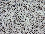 ZSCAN18 Antibody in Immunohistochemistry (Paraffin) (IHC (P))