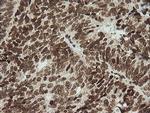 ZSCAN18 Antibody in Immunohistochemistry (Paraffin) (IHC (P))