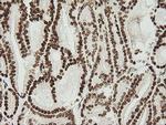 ZSCAN18 Antibody in Immunohistochemistry (Paraffin) (IHC (P))