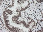 ZSCAN18 Antibody in Immunohistochemistry (Paraffin) (IHC (P))