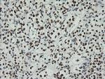 ZSCAN18 Antibody in Immunohistochemistry (Paraffin) (IHC (P))