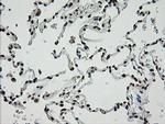 ZSCAN18 Antibody in Immunohistochemistry (Paraffin) (IHC (P))