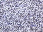 ZSCAN18 Antibody in Immunohistochemistry (Paraffin) (IHC (P))