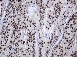 ZSCAN18 Antibody in Immunohistochemistry (Paraffin) (IHC (P))