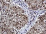 ZSCAN18 Antibody in Immunohistochemistry (Paraffin) (IHC (P))