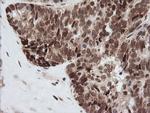ZSCAN18 Antibody in Immunohistochemistry (Paraffin) (IHC (P))