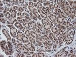 ZSCAN18 Antibody in Immunohistochemistry (Paraffin) (IHC (P))