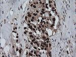 ZSCAN18 Antibody in Immunohistochemistry (Paraffin) (IHC (P))
