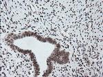 ZSCAN18 Antibody in Immunohistochemistry (Paraffin) (IHC (P))