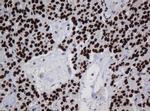ZSCAN18 Antibody in Immunohistochemistry (Paraffin) (IHC (P))