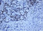 ZSCAN18 Antibody in Immunohistochemistry (Paraffin) (IHC (P))
