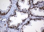 ZSCAN18 Antibody in Immunohistochemistry (Paraffin) (IHC (P))