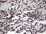 ZSCAN18 Antibody in Immunohistochemistry (Paraffin) (IHC (P))